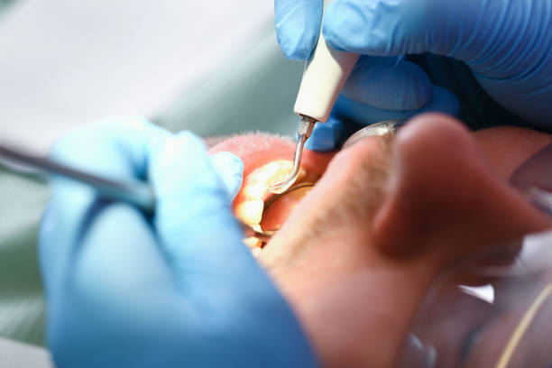 Best Broken or Chipped Tooth Repair in Vauxhall, NJ