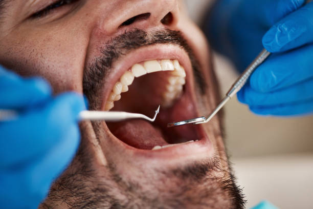 Best Emergency Denture Repair in Vauxhall, NJ